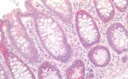 Claudin-3 Antibody, Novus Biologicals 50 &mu;g | Buy Online | Novus Biologicals | Fisher Scientific